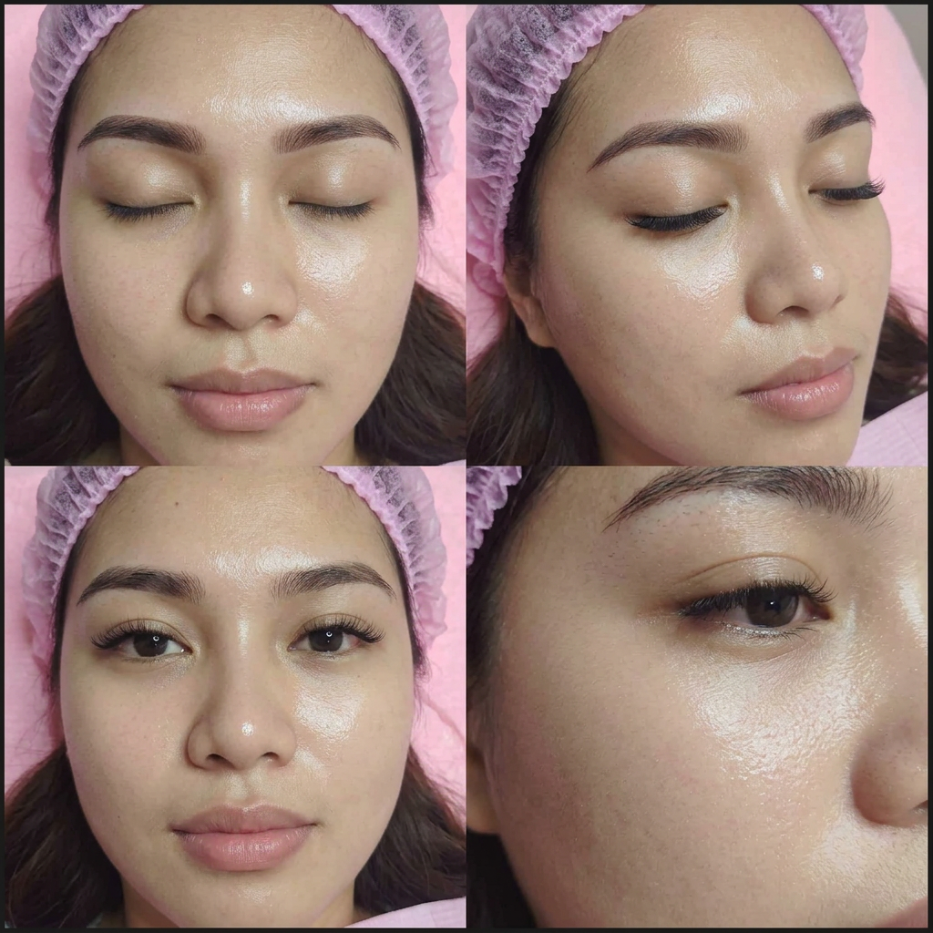 Facial glow result